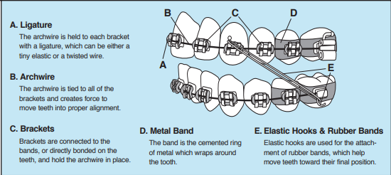 Post-Op Instructions For Orthodontic Appliances
